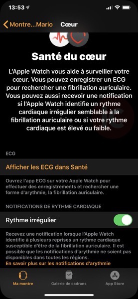 ECG app ios 13 beta 5